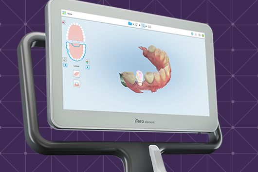 Align Technology and Desktop Metal Announce Strategic Collaboration to Make  iTero Element™ Flex the Preferred Restorative Intraoral Scanner for Desktop  Labs' Customers Serving General Dentists