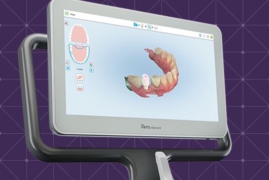 ITERO SCANNER — Valiente Dental